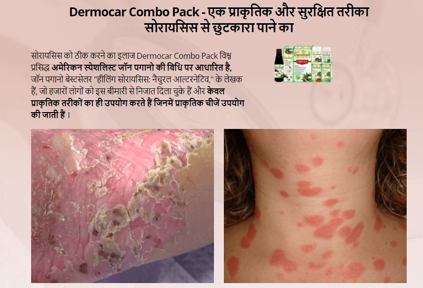 Dermocar Combo Pack Price in India