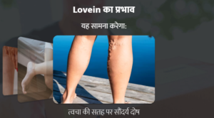 Lovein Cream price in india