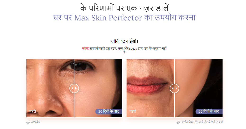 Max Skin Perfector benefits